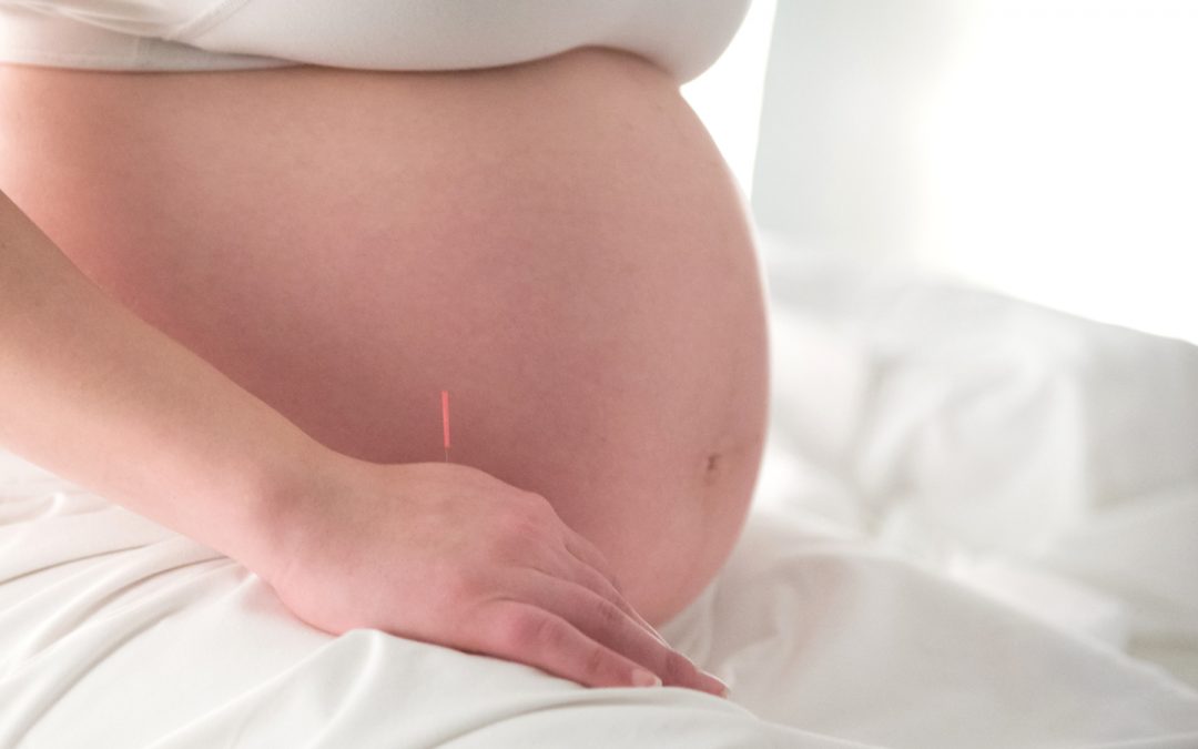 Acupuncture and Pregnancy | The Medical Sanctuary